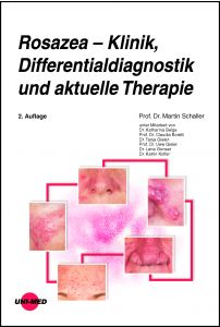 Rosazea – Klinik, Differentialdiagnostik und aktuelle Therapie