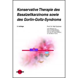 Konservative Therapie des Basalzellkarzinoms sowie des Gorlin-Goltz-Syndroms